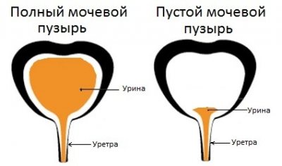 Давит на мочевой пузырь у женщин причины и хочется в туалет по маленькому